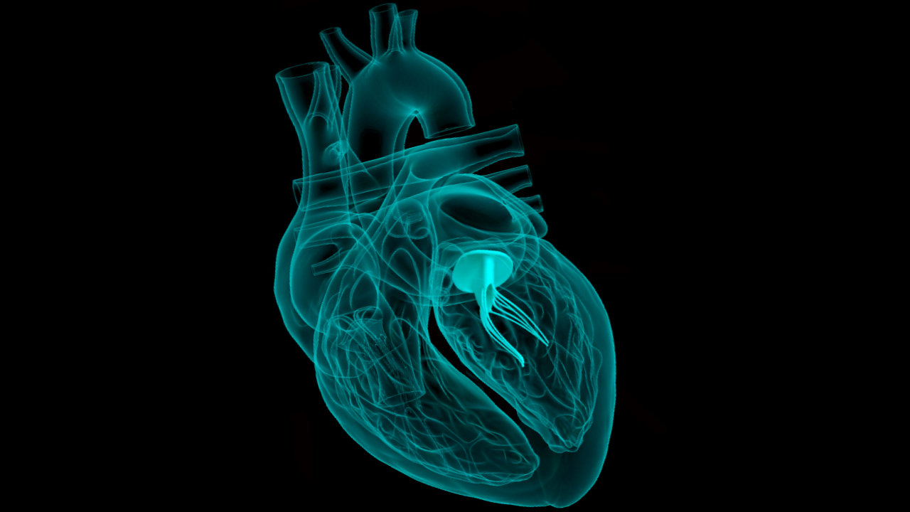 Structural Heart Therapy